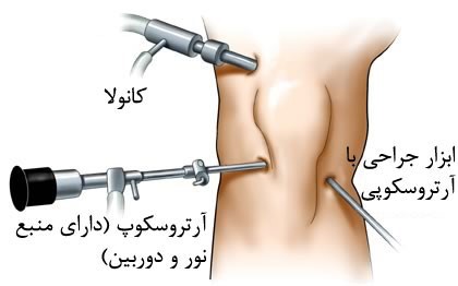رباط صلیبی