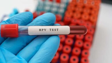 تست اچ پی وی - آزمایش اچ پی وی - hpv - HPV