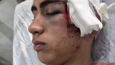 تنبیه بدنی دانشآموز در دهبکری